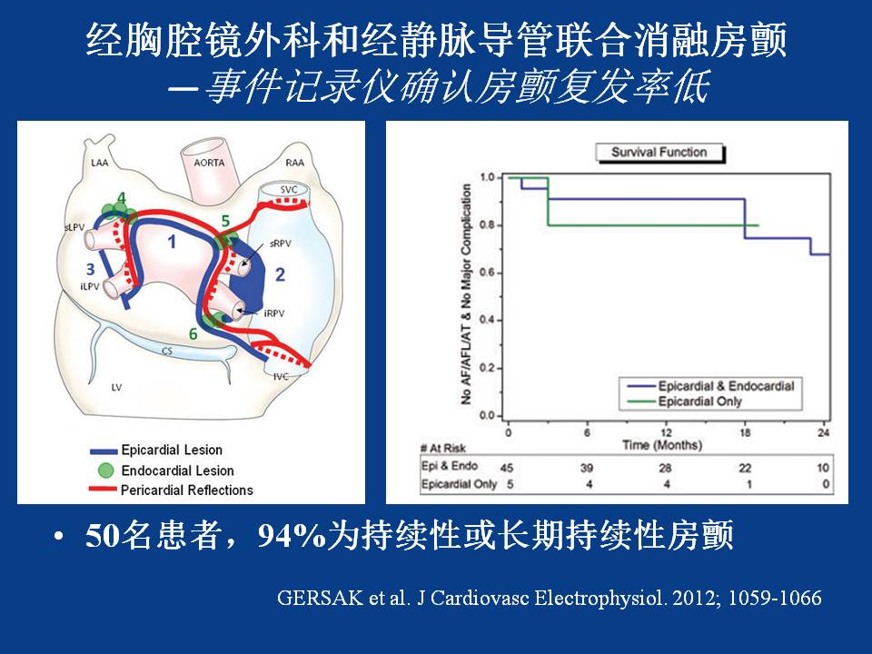 房颤的心外膜消融