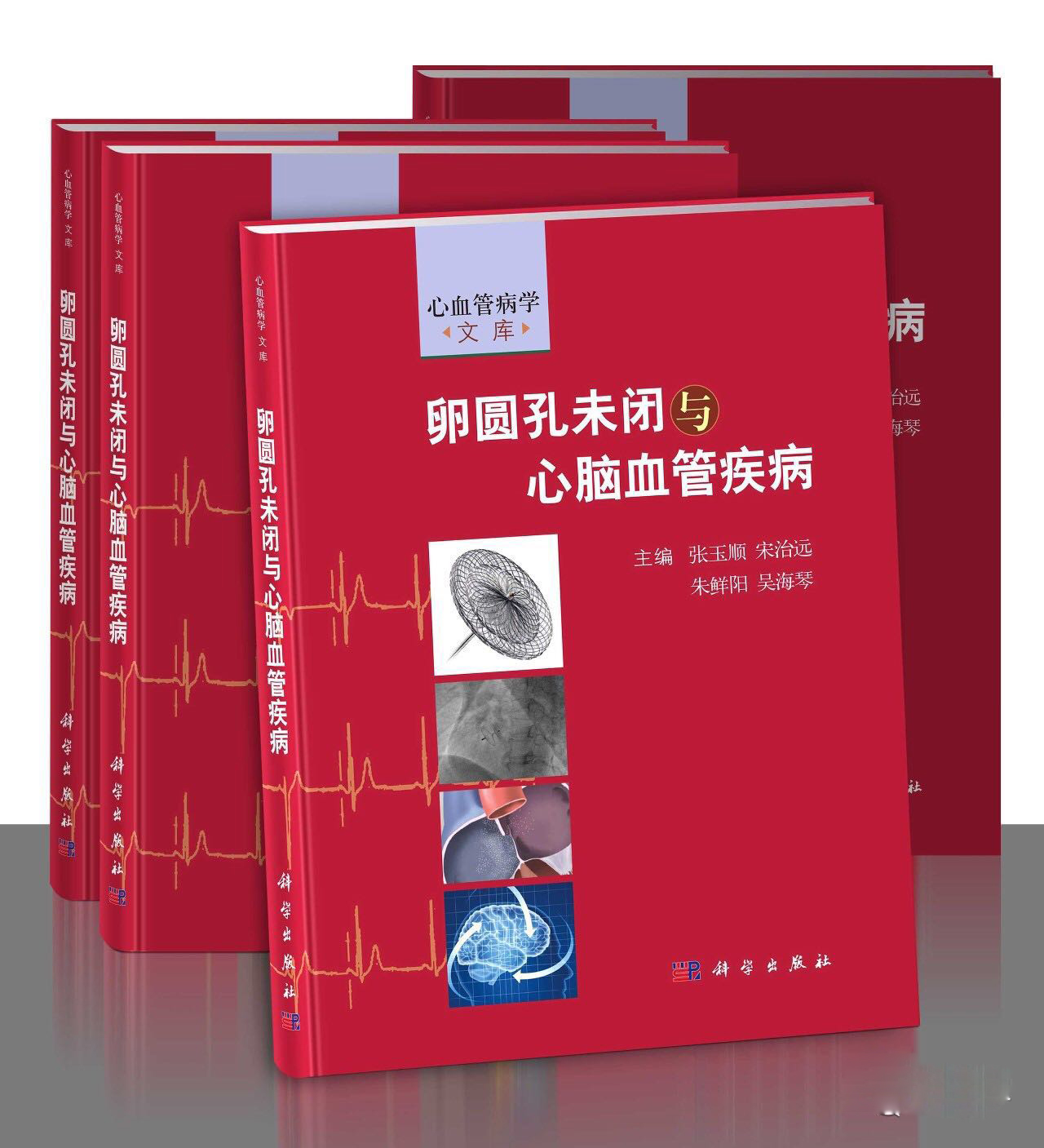 新书发布 |《卵圆孔未闭与心脑血管疾病》由科学出版社出版发行