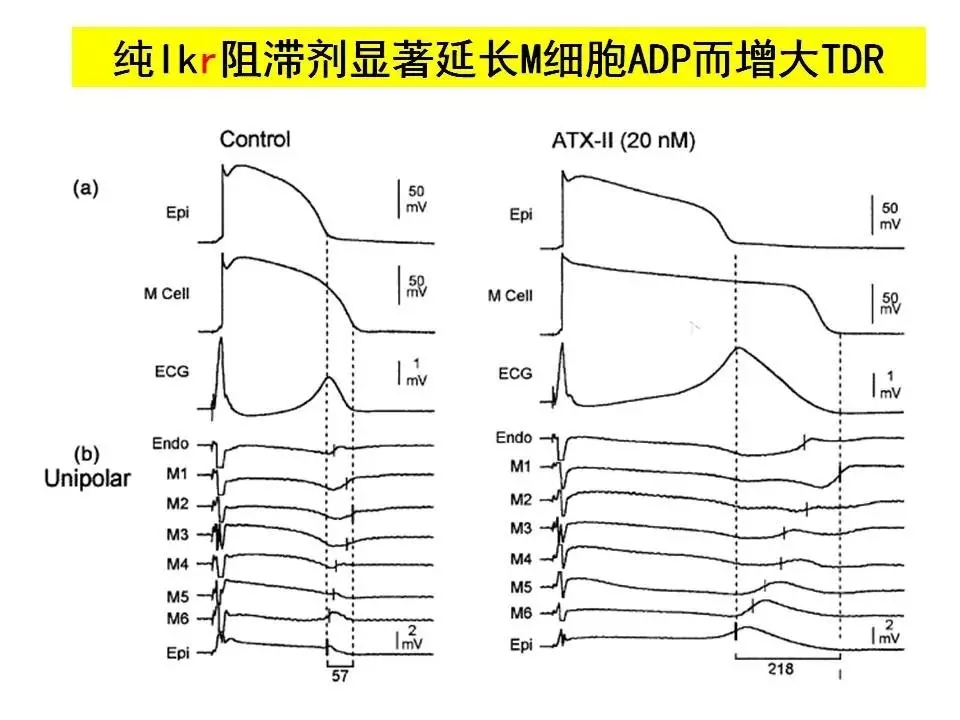 舒茂琴：抗心律失常药物临床应用——老药新用