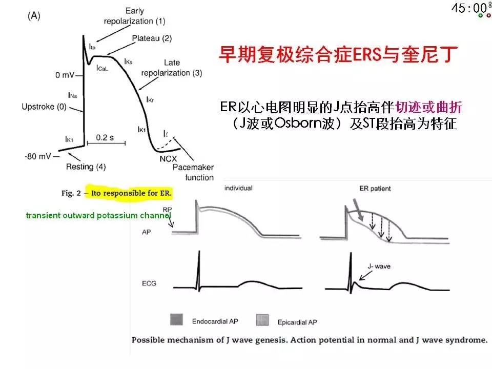 舒茂琴：抗心律失常药物临床应用——老药新用