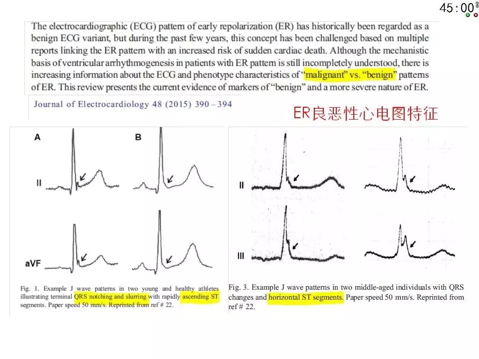 舒茂琴：抗心律失常药物临床应用——老药新用