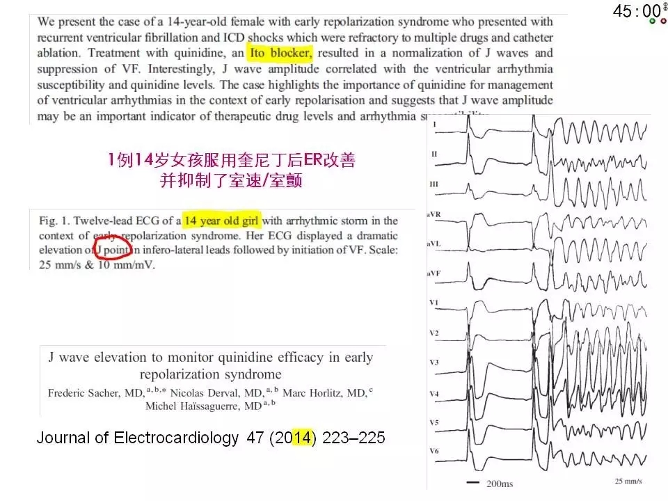 舒茂琴：抗心律失常药物临床应用——老药新用