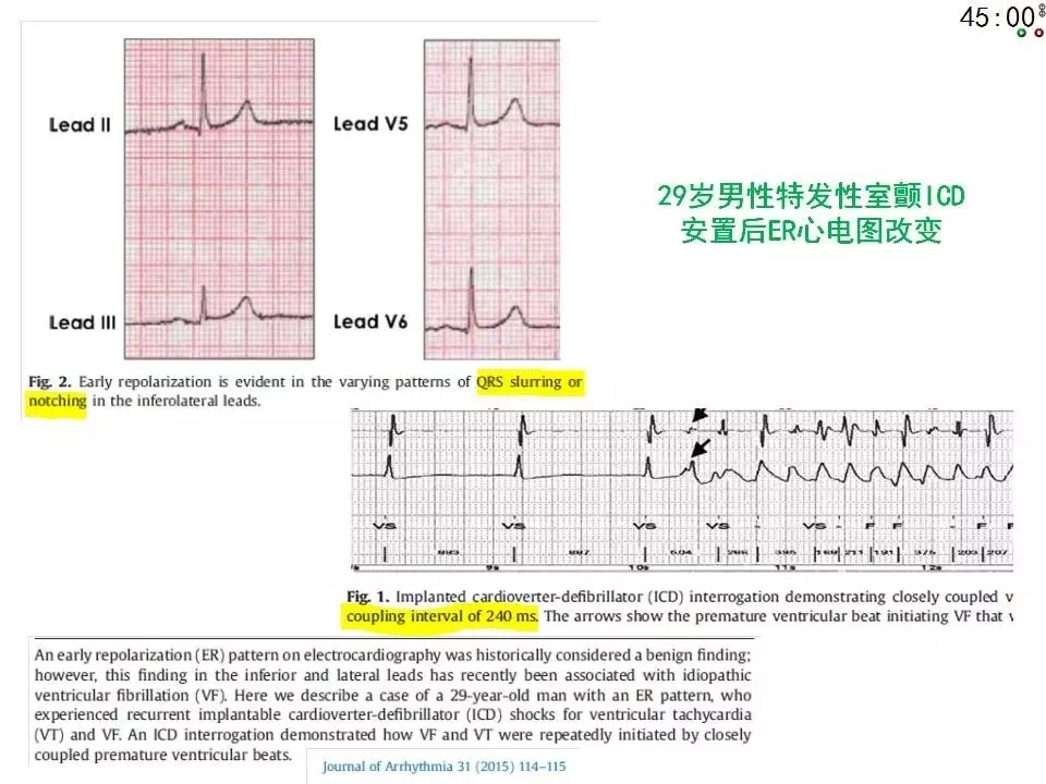 舒茂琴：抗心律失常药物临床应用——老药新用