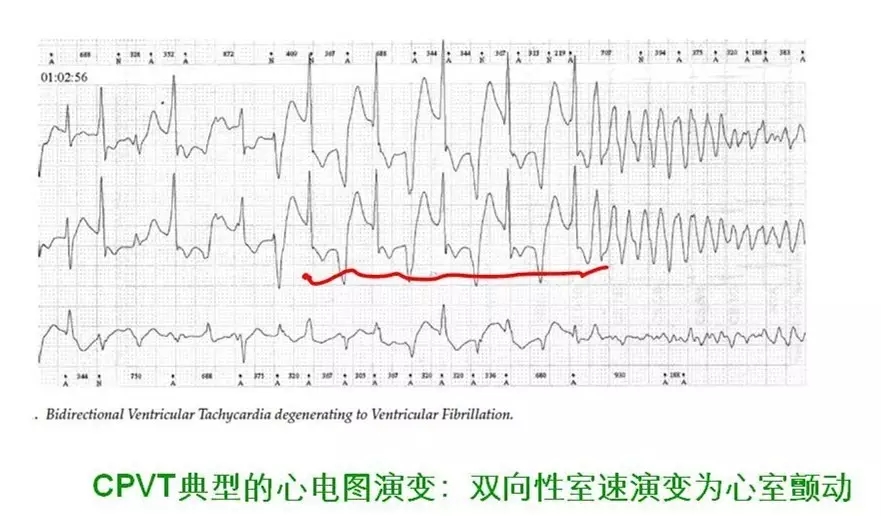 舒茂琴：抗心律失常药物临床应用——老药新用