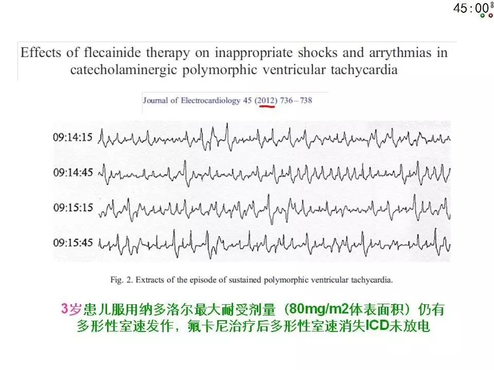 舒茂琴：抗心律失常药物临床应用——老药新用