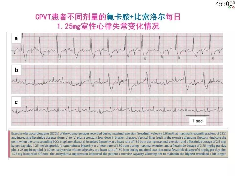 舒茂琴：抗心律失常药物临床应用——老药新用