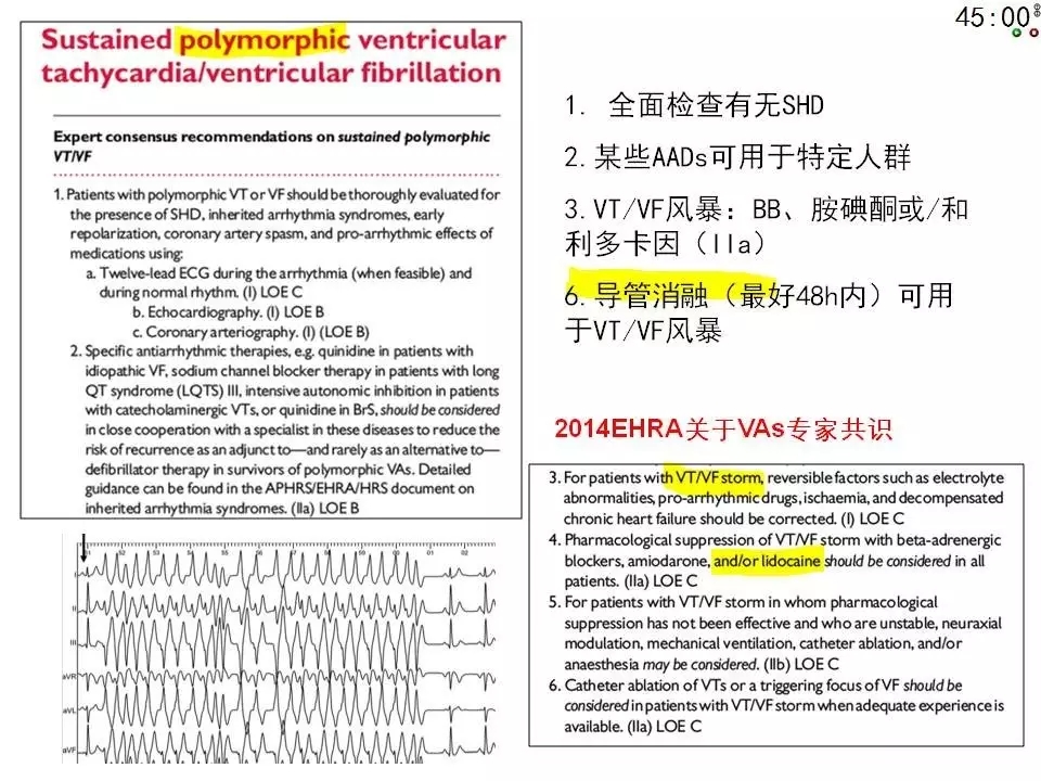 舒茂琴：抗心律失常药物临床应用——老药新用