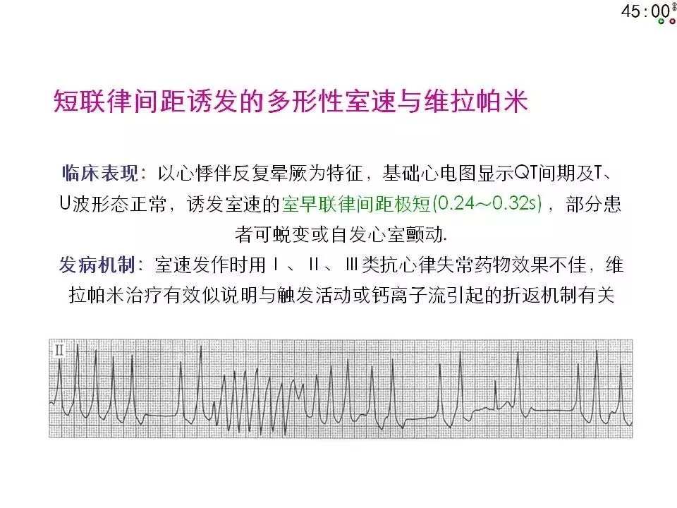 舒茂琴：抗心律失常药物临床应用——老药新用