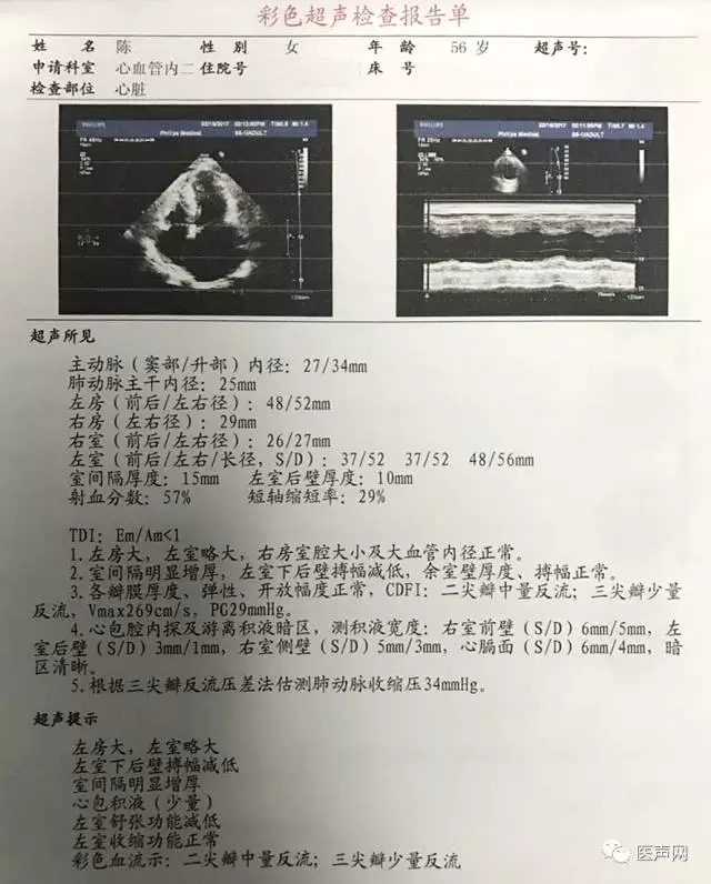 姚晓伟：陕西省人民医院首例-ICM