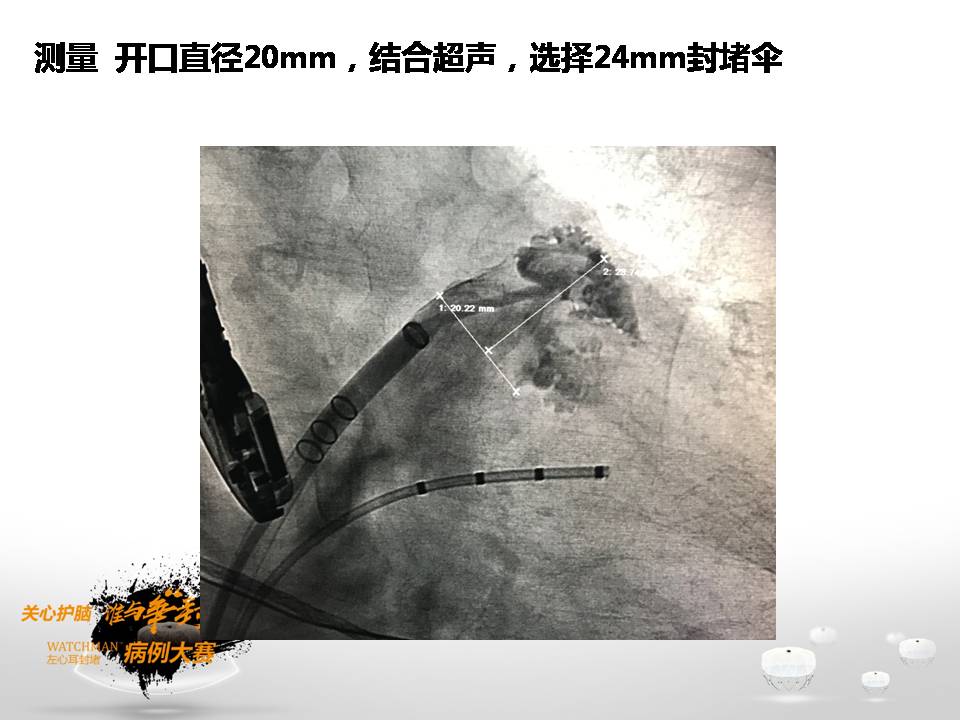 幻灯片9.JPG