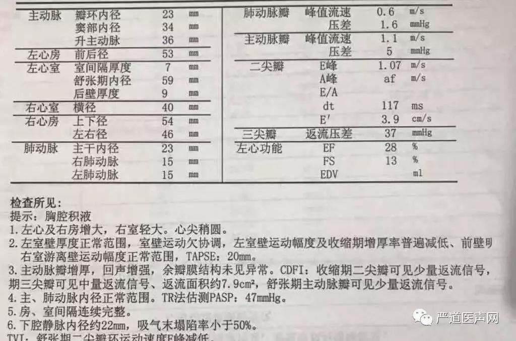 硝酸酯规范应用病例 张晓卉:缺血性心肌病一例