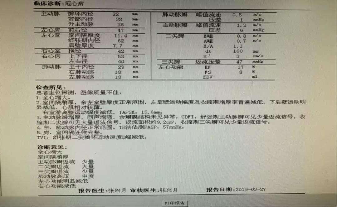 足背动脉搏动减弱 足背动脉搏动检查 足背动脉搏动位置 足背动脉搏动的意义